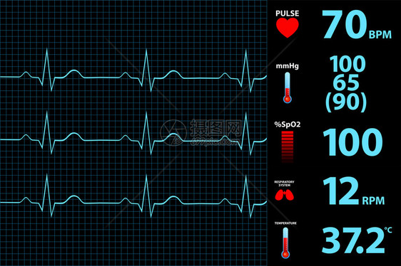 现代心电图显示器显示矢量图图片