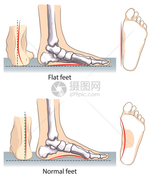 脚的胖瘦怎么分类 (脚的胖瘦怎么分辨)