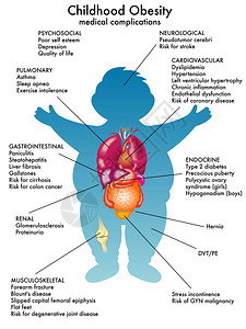 详细说明白背景儿童肥胖症的矢量插图以白图片