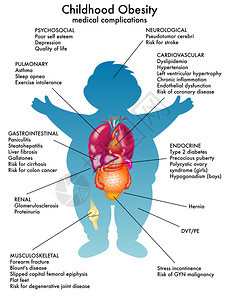 详细说明白背景儿童肥胖症的矢量插图以白背景图片