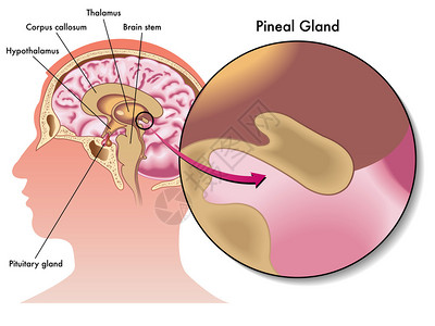 松树腺及其位置的医学图片