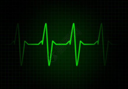 绿色的心脏频率图片