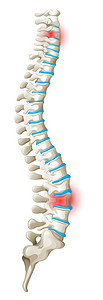 脊椎背痛图解图片
