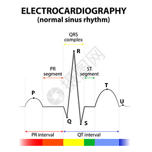 以正常鼻弦节奏的心脏ECG示意图表达式图片