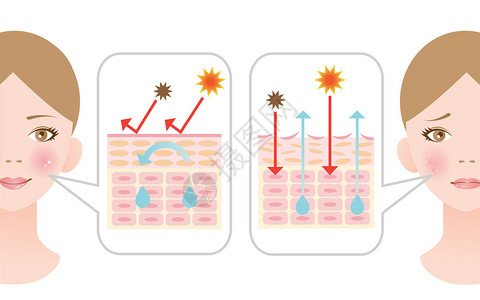 皮肤图示干皮肤和健康图片