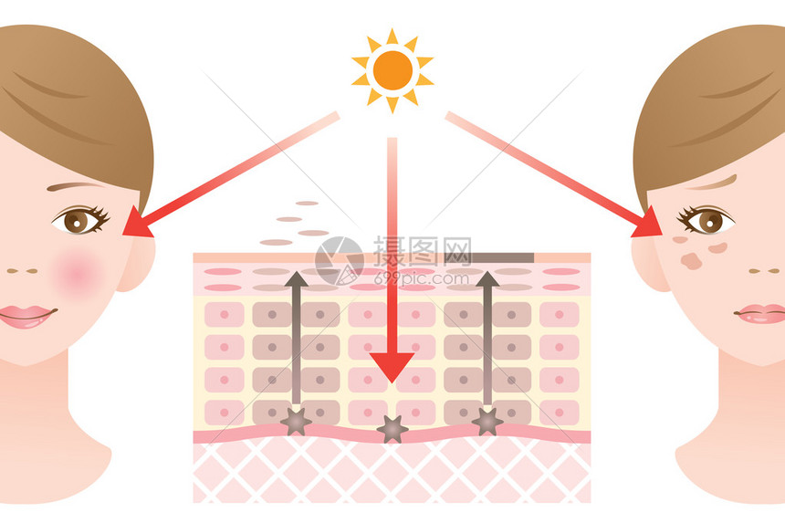 信息图表皮肤插图皮肤斑点机制图片