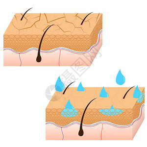 皮肤水合和干皮肤部分图片