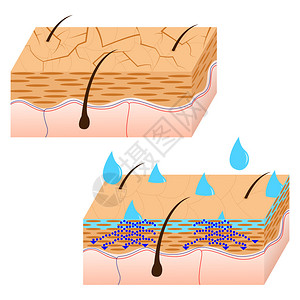 皮肤水合和干皮肤部分图片