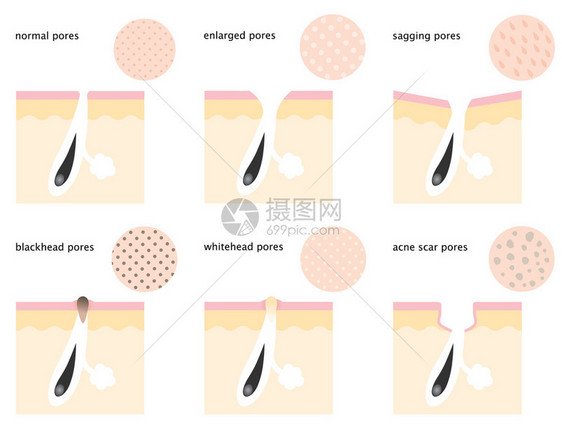 皮肤毛孔图图片
