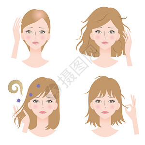 女常见的头发问题是脱发头发稀疏秃顶损伤分叉头发不规图片