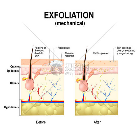 去角质或剥离是一种美容程序图片