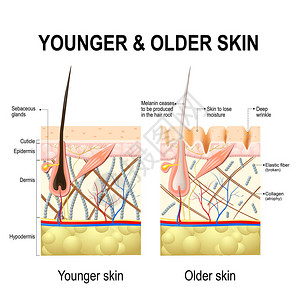 人体皮肤变化或皮肤老化图片
