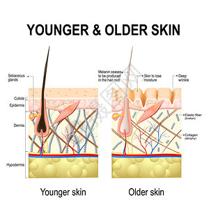 人体皮肤变化或皮肤老化图片
