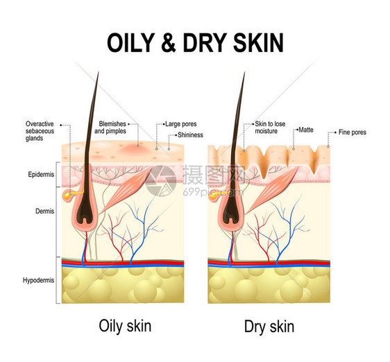油和干皮肤不同的人类皮肤类型和状况白色背景上人体皮肤的图解剖图片
