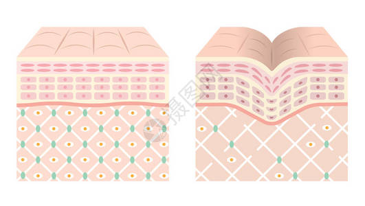 年轻皮肤和老皮肤的图表图片