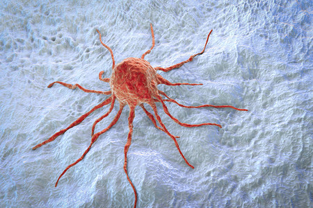 癌症细胞肿瘤细胞近图片