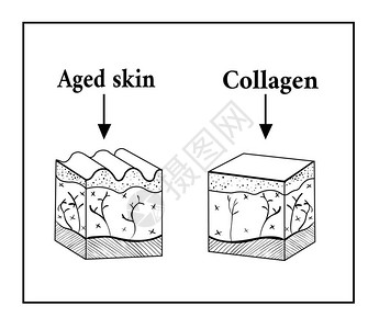 受胶原蛋白影响的皮肤示意图老和胶原蛋白皮肤矢量图的皮肤皱纹草图图片
