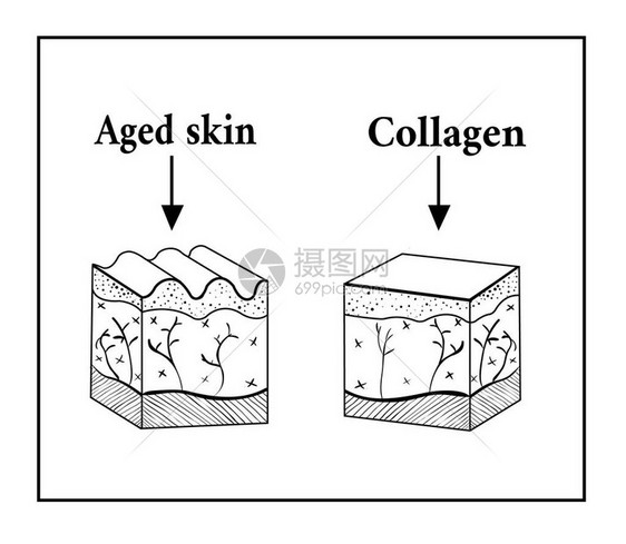 受胶原蛋白影响的皮肤示意图老和胶原蛋白皮肤矢量图的皮肤皱纹草图图片