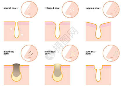 鼻部的一组皮肤孔图片