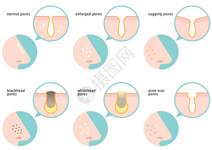 鼻部的一组皮肤孔图片