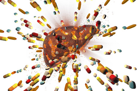 药物引起的肝毒概念图图片