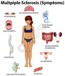 多发硬化症教育海报插图图片