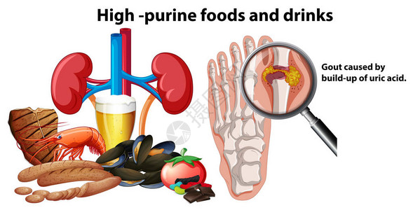 高嘌呤食物和插图图片