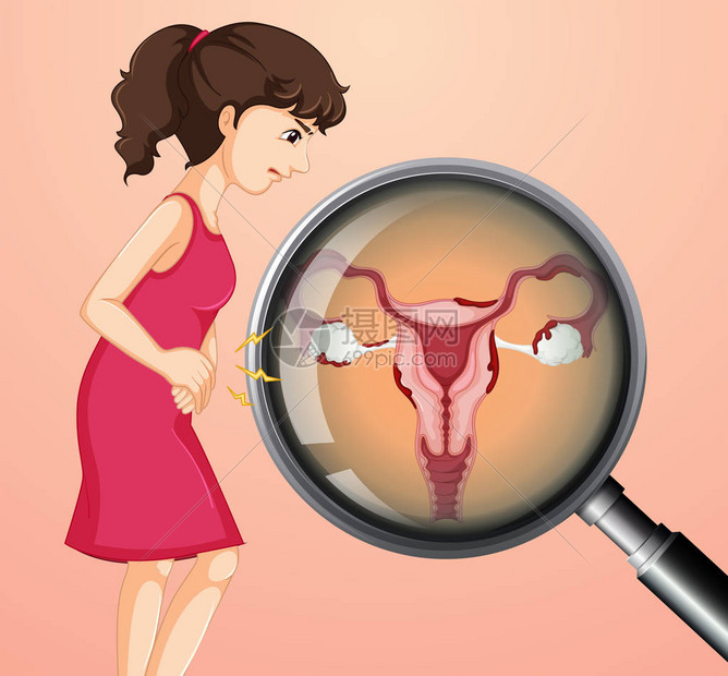 妇女与Ovari图片