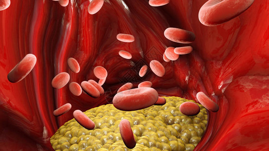 红血细胞图片