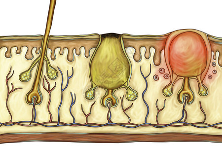 脑损伤的病理学说明显示正常发型与左sebaceousglands左图片