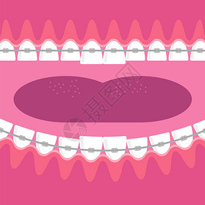 牙齿牙科护理背景矫形治疗卡通图片