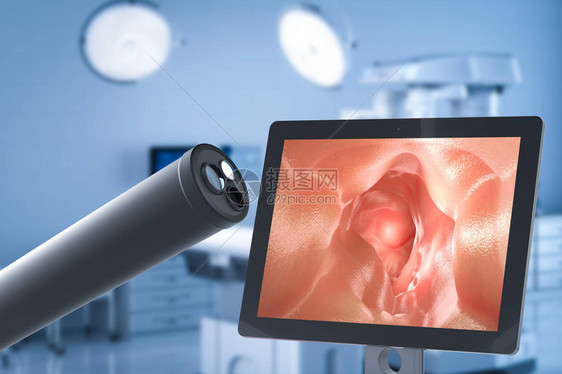 医疗技术概念有3D制成内容镜和图片
