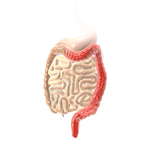 显示溃疡结肠炎UC结肠和直肌炎症和溃疡的3D插图图片