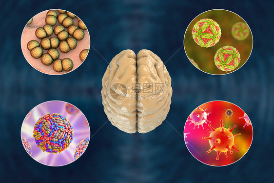 脑感染微生物引起脑炎和图片