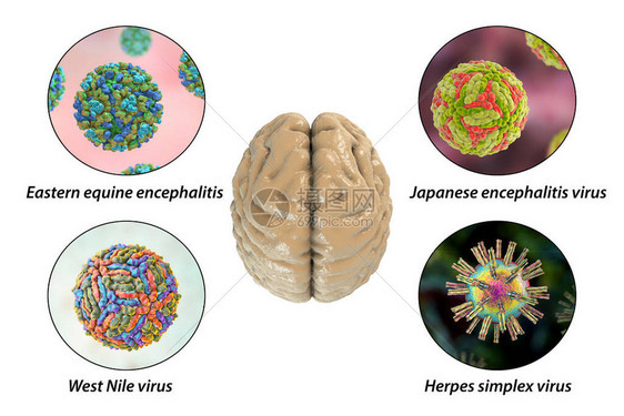 脑感染微生物引起脑炎和图片