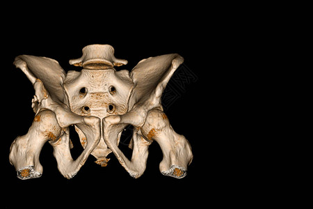 骨盆CT扫描3D渲染图像显示图片