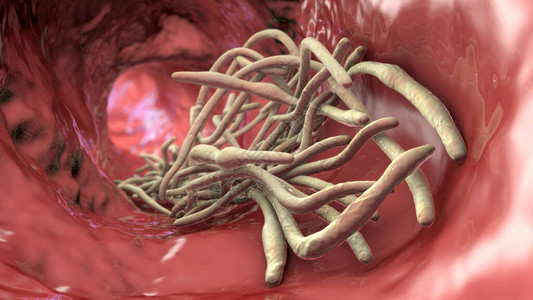 肠道3D图例的润滑液中的寄生虫阿斯卡里图片