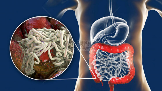 人类大型肠道中的寄生虫图片