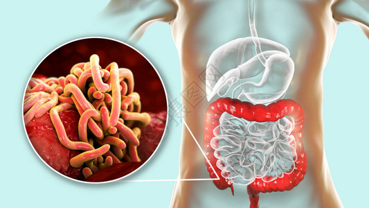 人类大型肠道中的寄生虫图片