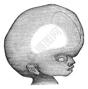 脑积水复古雕刻图片