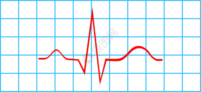 电动心电图矢量一中的正常气态和脉图片