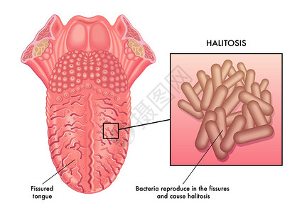 人类的舌头与细菌图片