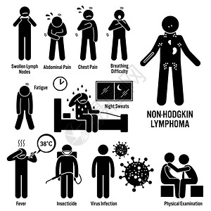 一组非霍奇金淋巴瘤淋巴癌疾病的插图图片