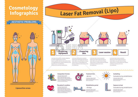 矢量插图集激光脂脂肪切除图片