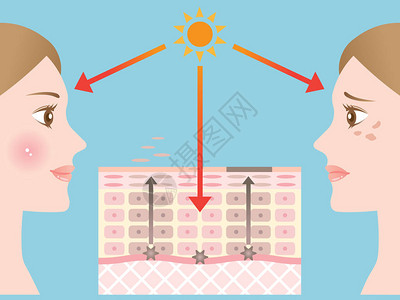 皮肤斑点的机制图片