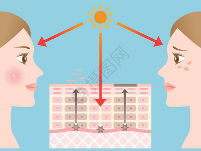 皮肤斑点的机制图片