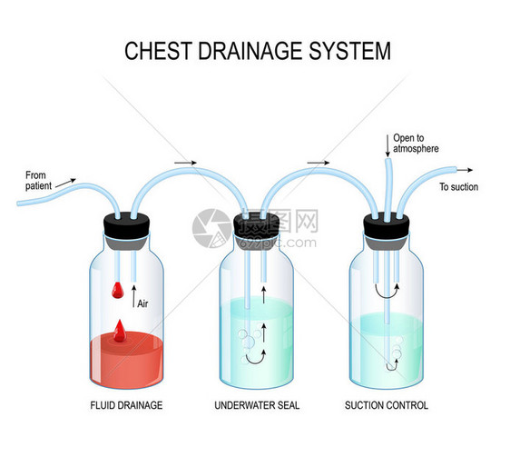 胸腔引流系统图片