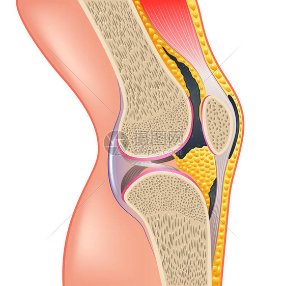 膝关节解剖学在白色真实感矢量图上被隔离图片