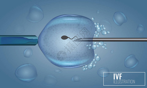 体外受精注射人工受精科学医病媒说明三图片