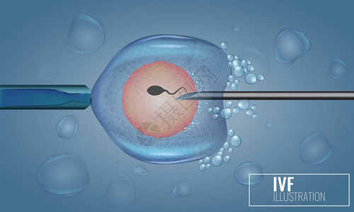 体外受精注射人工受精科学医病媒说明三图片